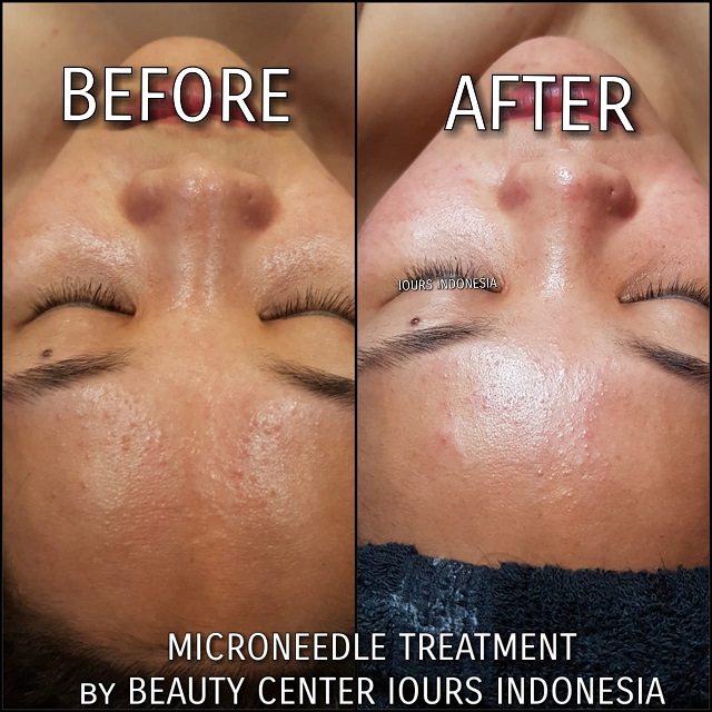 Beauty Treatment
