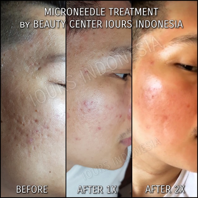 Beauty Treatment