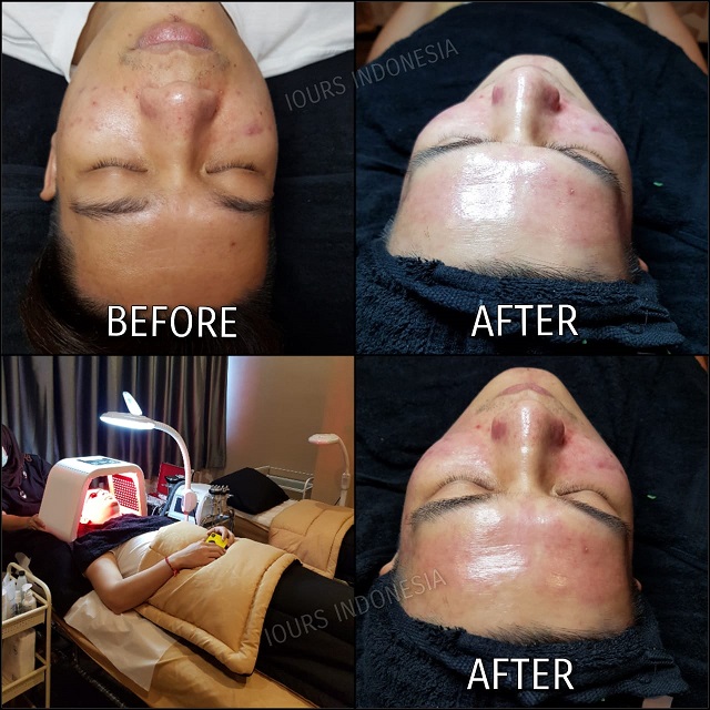 Beauty Treatment